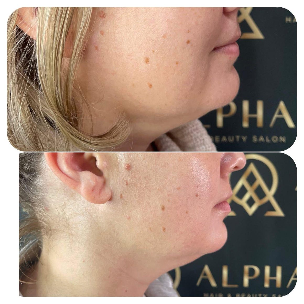 facial-massage-treatments-at-Alpha-Hair-Beauty-Malta